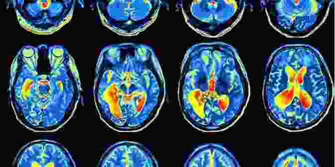 Brain Scan Revealing The Neural Activity Associated With Aesthetic Appreciation A Hunger For Aesthetics: Enacting The Demands Of Art (Columbia Themes In Philosophy Social Criticism And The Arts)