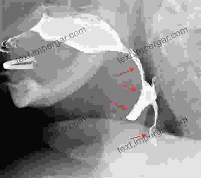 Fluoroscopic Image Of Swallowing The Clinician S Guide To Swallowing Fluoroscopy