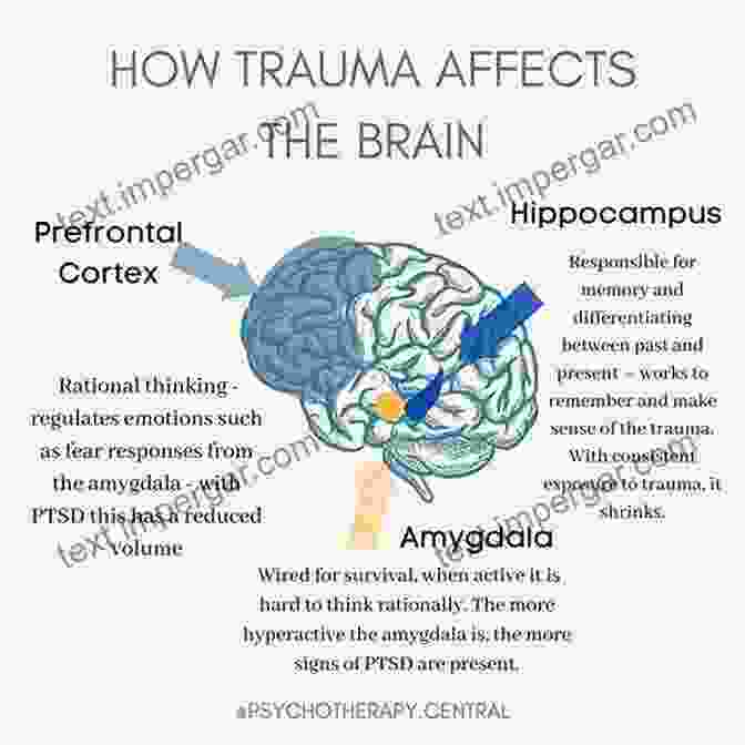 Image Depicting The Impact Of Trauma On The Brain And Body Don T Believe Your Brain : Your 9 Step Guide From Trauma To Triumph