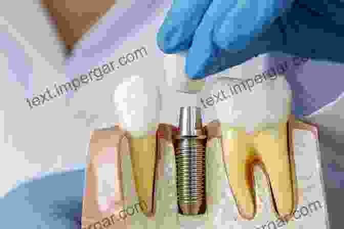 Patient Centered Implant Dentistry Journal Of Prosthodontics On Dental Implants