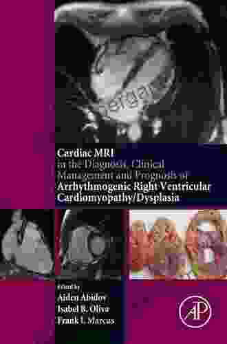 Cardiac MRI In Diagnosis Clinical Management And Prognosis Of Arrhythmogenic Right Ventricular Cardiomyopathy/Dysplasia