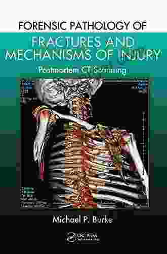 Forensic Pathology Of Fractures And Mechanisms Of Injury: Postmortem CT Scanning