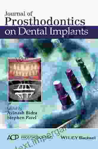 Journal Of Prosthodontics On Dental Implants