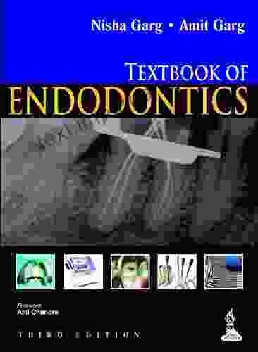 Textbook Of Endodontics Nisha Garg