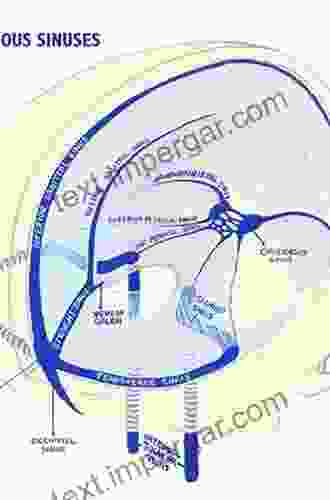 Anatomy Imaging And Surgery Of The Intracranial Dural Venous Sinuses