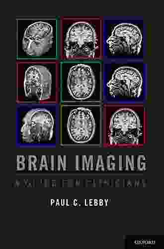 Brain Imaging: A Guide For Clinicians