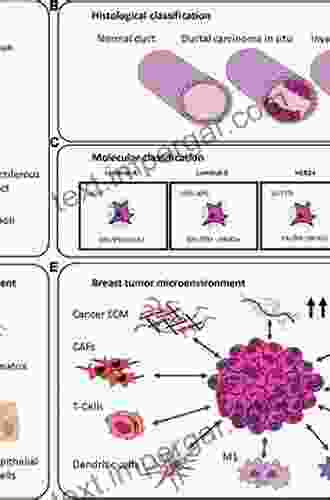 Biochemical Studies On Some Tumor Markers In Breast Cancer